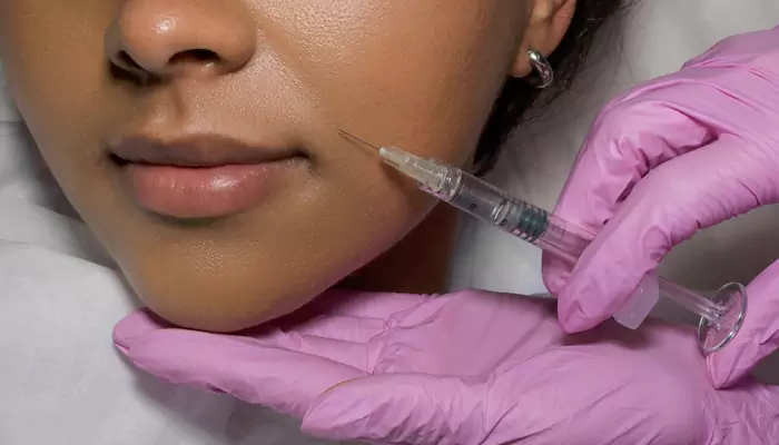 How Dermal Fillers Can Improve The Appearance Of Fine Lines And Wrinkles