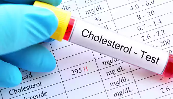 High Cholesterol: Is It Genetic Or Lifestyle Problem?